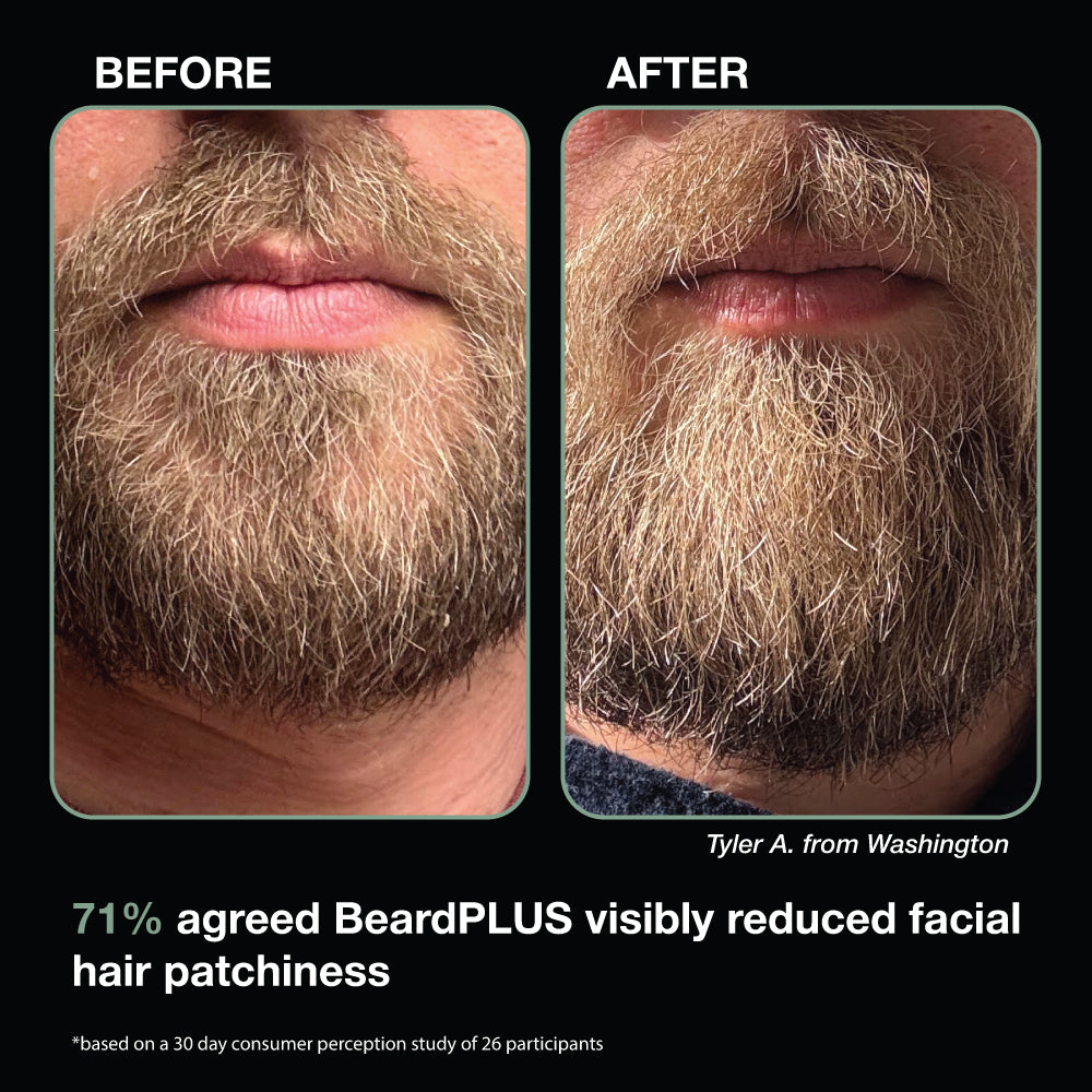 BeardPLUS Shampoo reduces patchiness