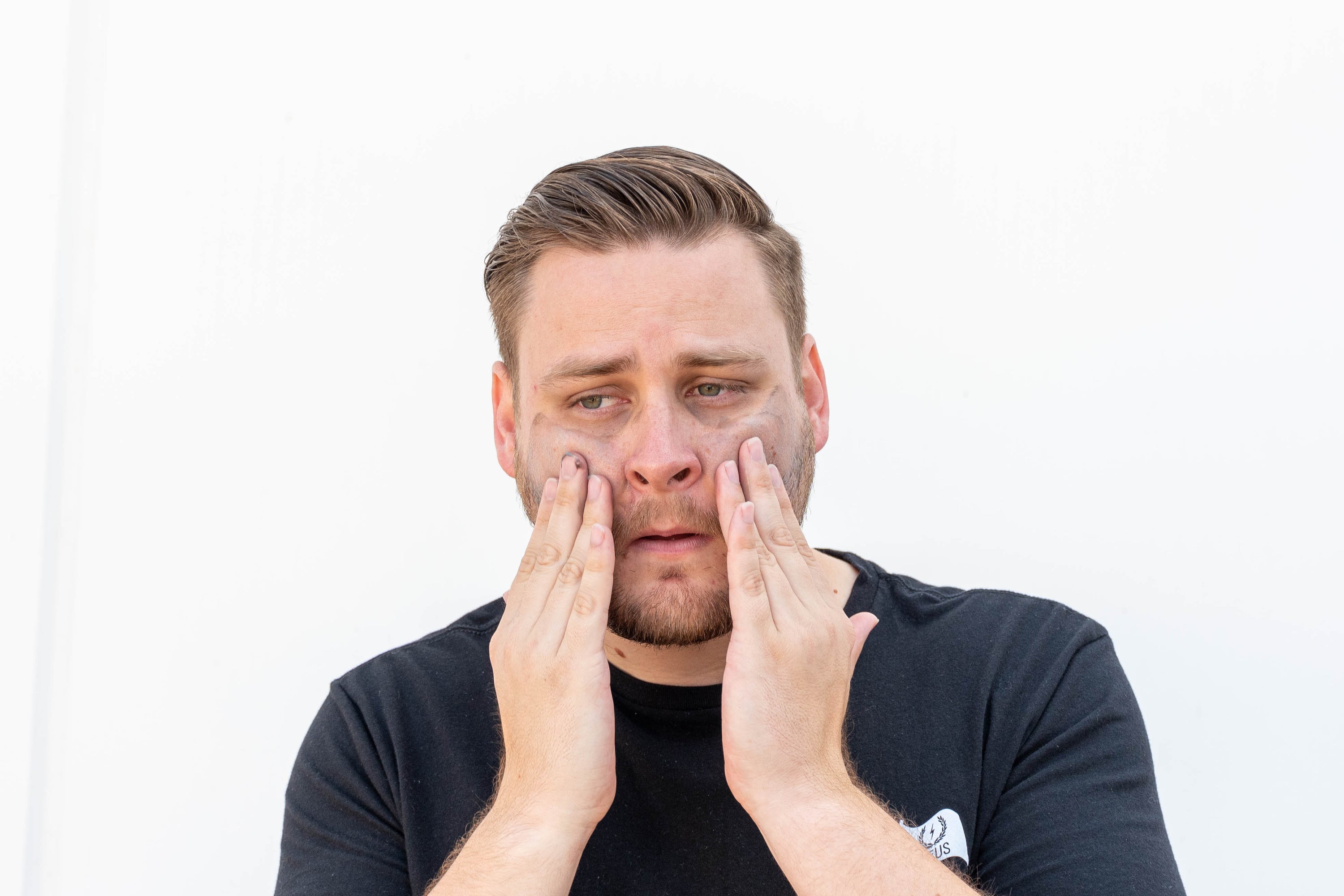 How To Prevent and Treat Beard Acne Zeus