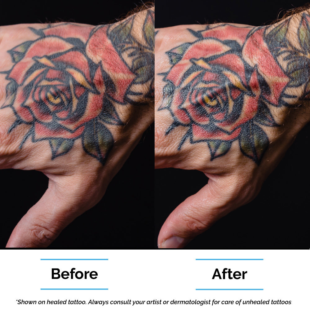 ope ope no mi tattoo|TikTok Search